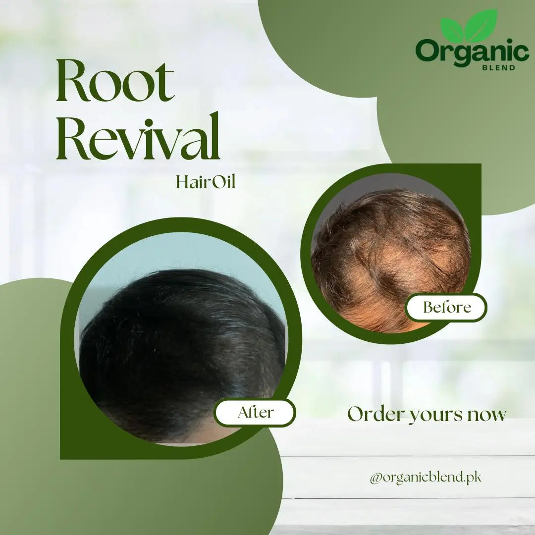 Root Revival